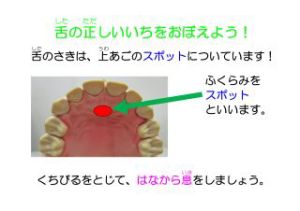 ����グ��