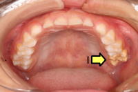 �P���ƑO���̌`���s�S��