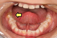 MIH�`���s�S��