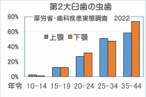１２才臼歯の虫歯